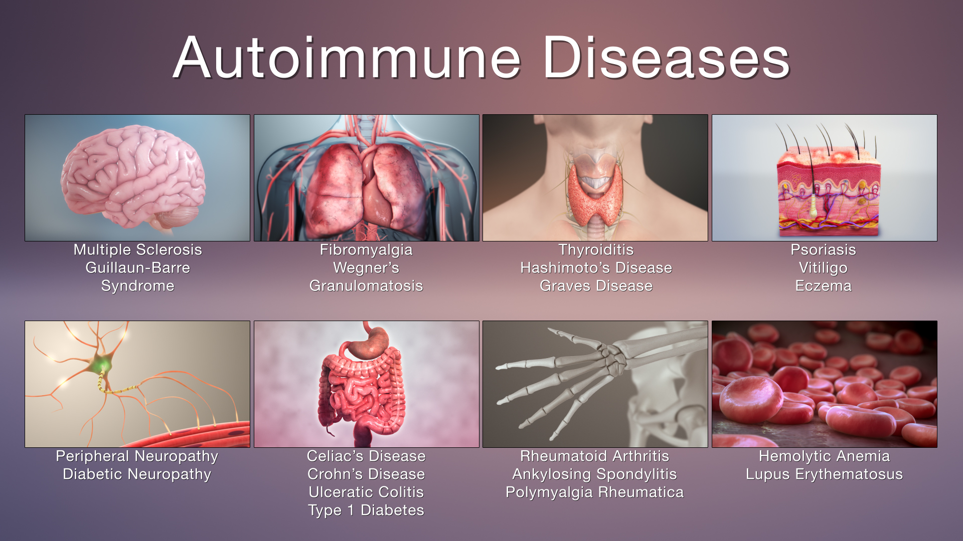 What Is Auto Immune Disease Myositis