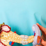 Can pancreatitis cause belly fat?