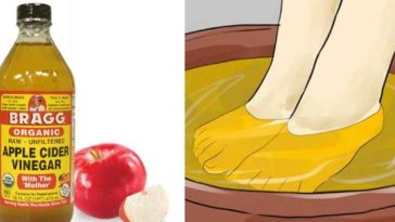 Can you soak liver in vinegar?