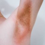 Does KY jelly cause yeast infections?