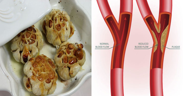 Does garlic salt raise blood pressure?