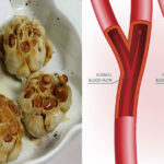 Does garlic salt raise blood pressure?