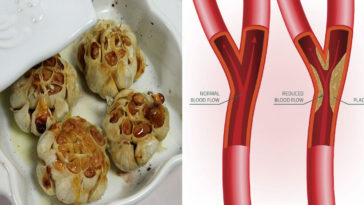 Does garlic salt raise blood pressure?