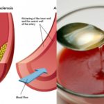 Does lemon juice clean your arteries?