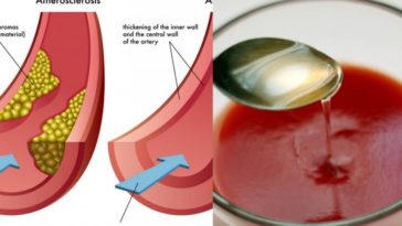 Does lemon juice clean your arteries?