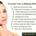How can I prevent pimples on my face permanently?