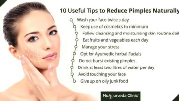 How can I prevent pimples on my face permanently?
