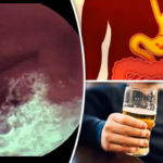How can I protect my stomach before drinking?