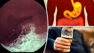 How can I protect my stomach before drinking?