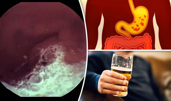 How can I protect my stomach before drinking?