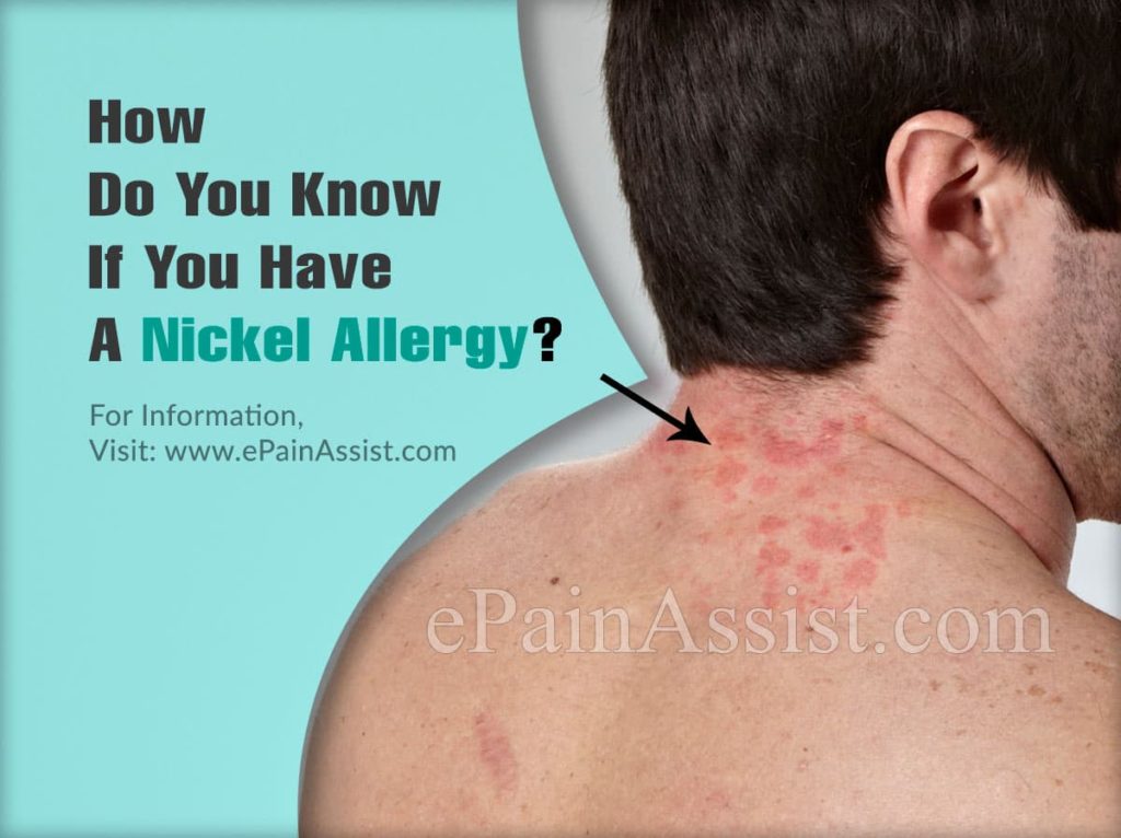 ピスタチオにアレルギーがあるかどうかはどうやってわかりますか？