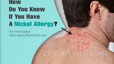 How do you know if you are allergic to pistachios?