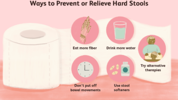 How do you pass a big hard stool?