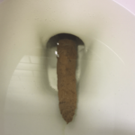 How do you push out poop when it's stuck?