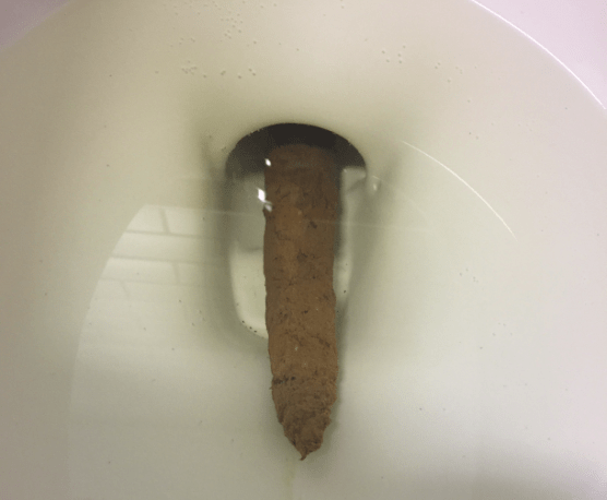 How do you push out poop when it's stuck?