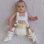 How long do babies wear a Pavlik harness?