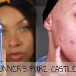 Is Dr Bronners bad for skin?