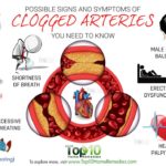 What age do arteries start to clog?