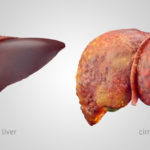 What alcohol is easiest on liver?