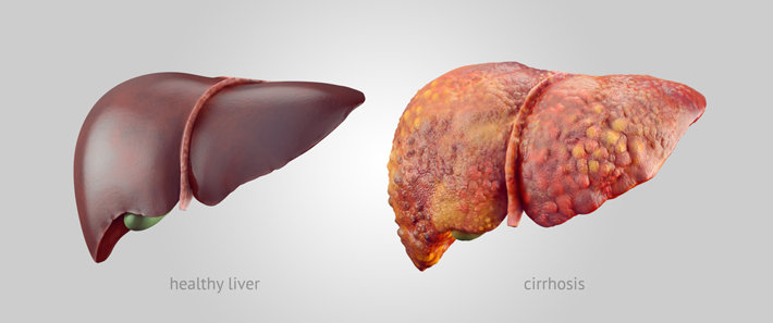 What alcohol is easiest on liver?