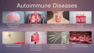 What are the 7 autoimmune diseases?