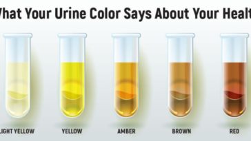 What color urine is bad?