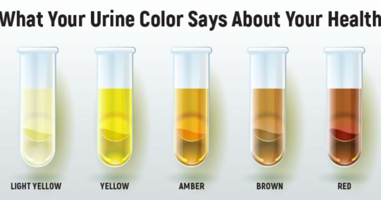 what-color-urine-is-bad