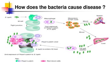 What disease does Lactobacillus cause?