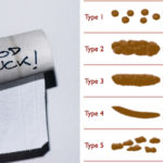 What do long skinny poops mean?