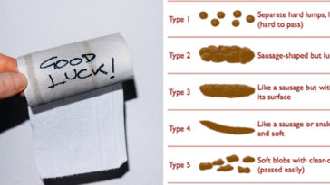 What do long skinny poops mean?