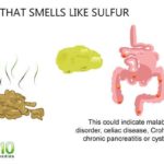 What does celiac poop smell like?