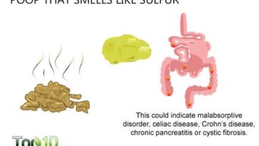 What does celiac poop smell like?