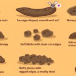 What does it mean when your poop is mushy?