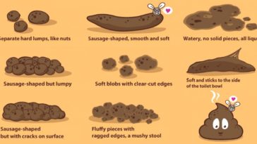 What does it mean when your poop is mushy?