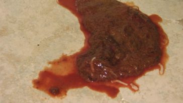 What does parvo poop look like?