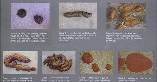 What does unhealthy poop look like?