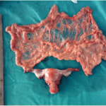 What is a normal sized wok?