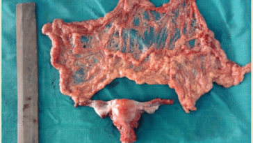 What is a normal sized wok?