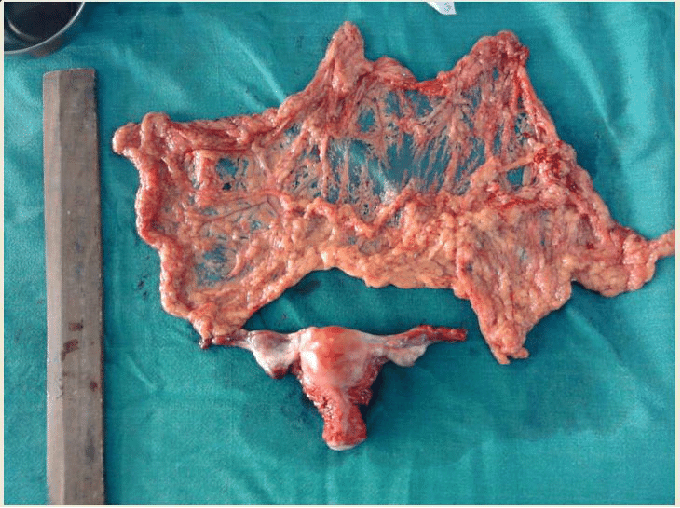 What is a normal sized wok?