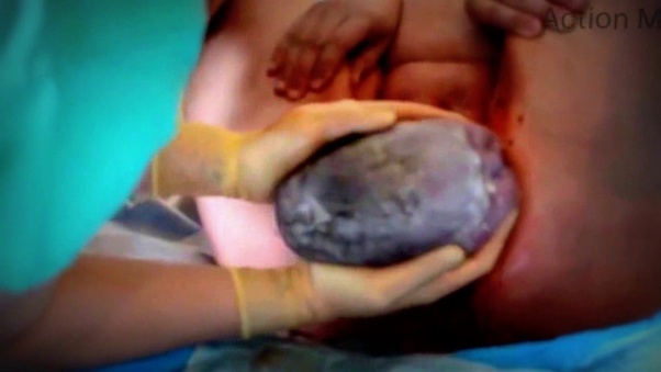 When did Baby Doe's close?