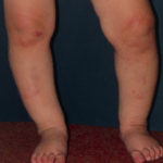 When do babies straighten their legs?