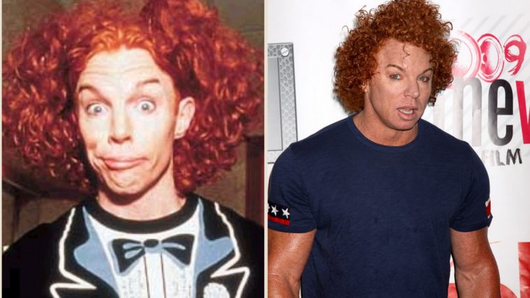 Why did Carrot Top plastic surgery?
