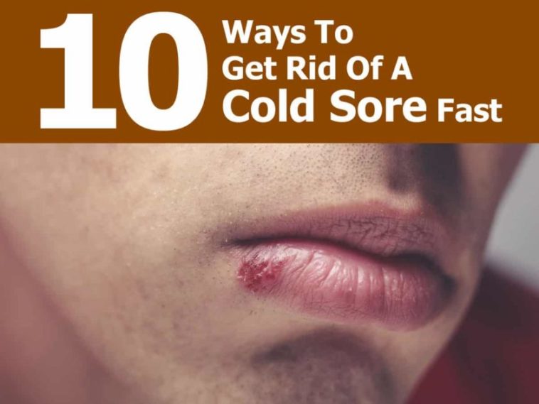 how-do-you-get-rid-of-cold-sores-asap