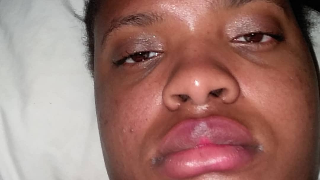 Are peaches in jail?