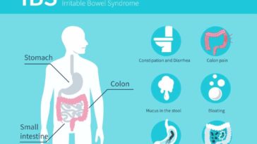 What are the worst symptoms of IBS?