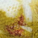 What does lactose intolerance poop look like?