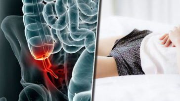 Why does my stomach hurt after Olive Garden?