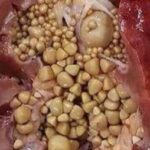 Can loaded teas cause kidney stones?