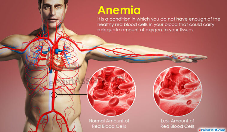 What causes Anemoia?