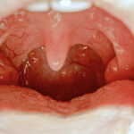 What is a Slubberdegullion?